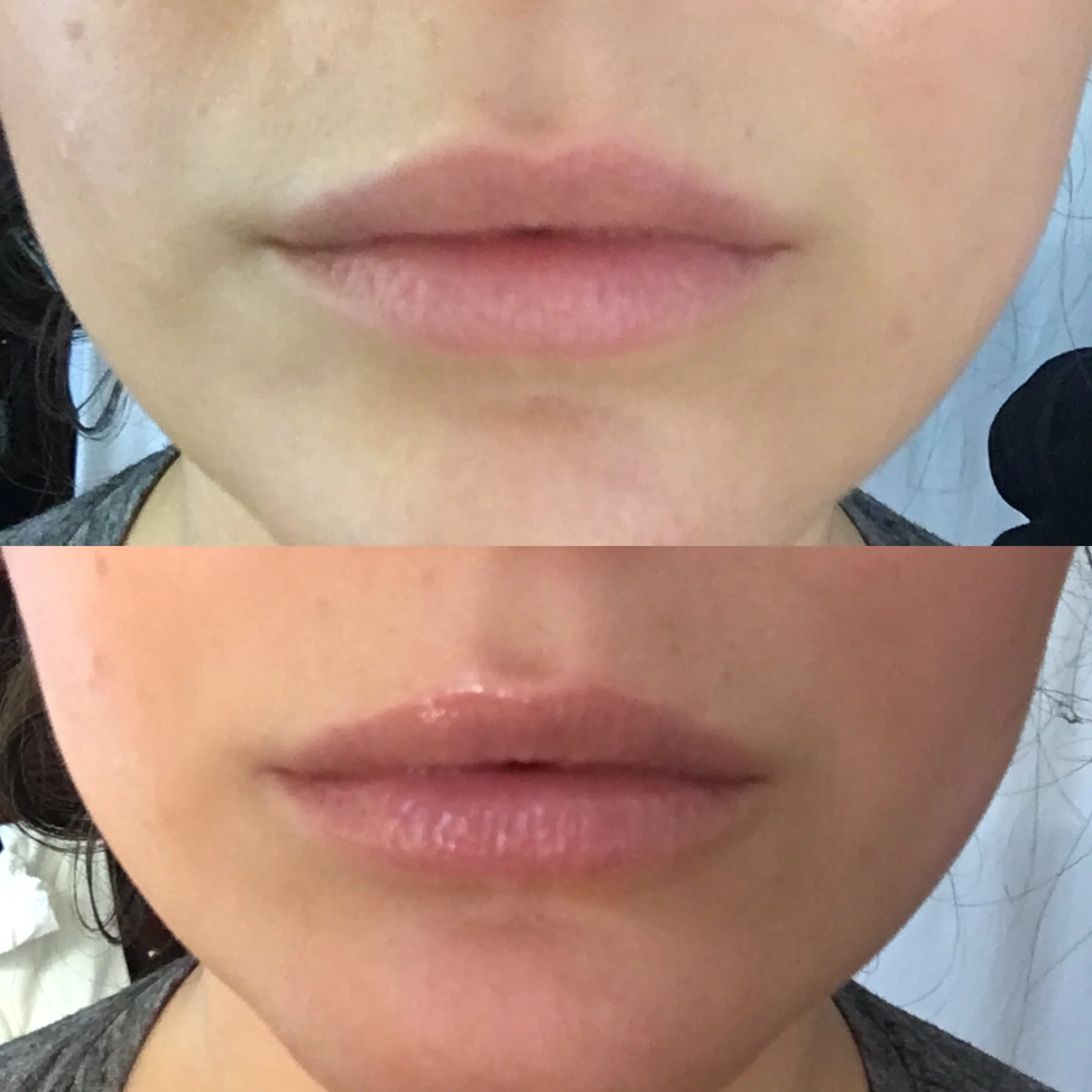 Dior lip plumper before and after hotsell
